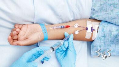 سرطان پستان