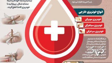 ببینید: چطور خونریزی را کنترل کنیم؟