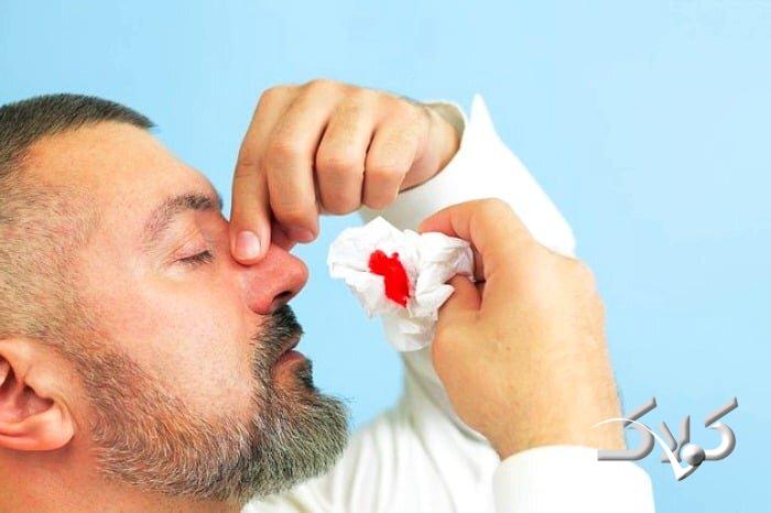 خون دماغ شدن مکرر - جلوگیری از خون دماغ شدن