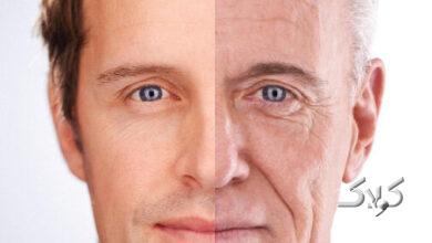aging face