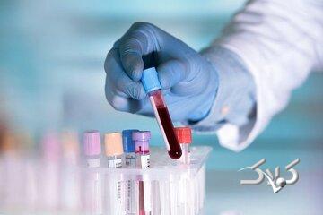 حذف یک آزمایش مهم از پوشش بیمه