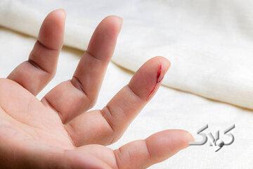 میوههایی که زخم را التیام میدهند