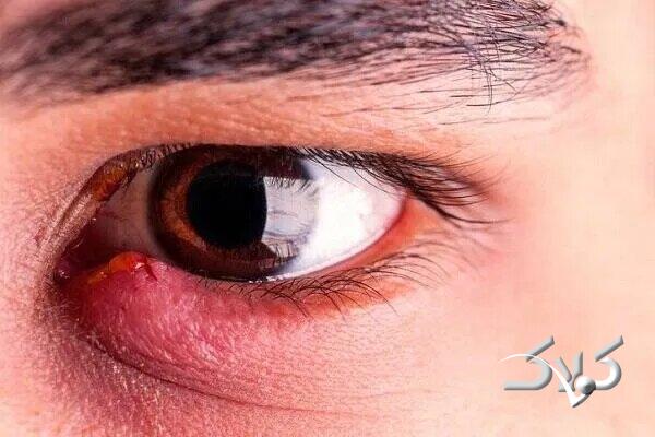 گل مژه