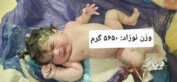 تولد نوزادی با وزن ۵ کیلو و ۶۵۰ گرم در کرمانشاه/ عکس
